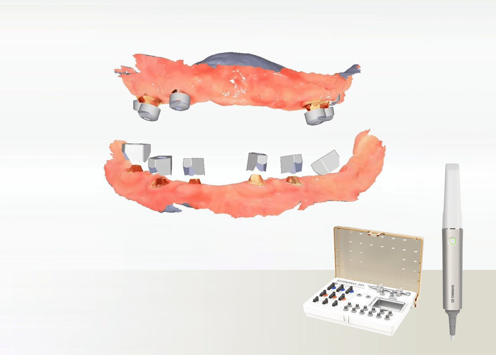 All-on-X用フォトグラメトリー付き高精度口腔内スキャナー
